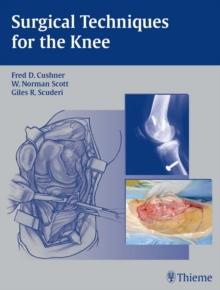 Surgical Techniques for the Knee