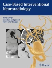 Case-Based Interventional Neuroradiology