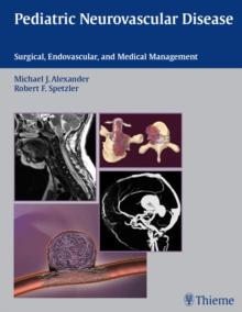 Pediatric Neurovascular Disease : Surgical, Endovascular, and Medical Management