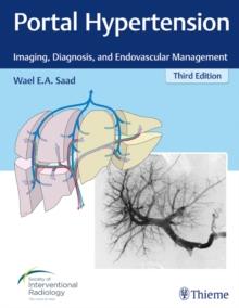 Portal Hypertension : Imaging, Diagnosis, and Endovascular Management