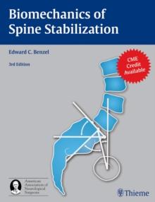 Biomechanics of Spine Stabilization