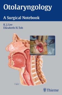 Otolaryngology : A Surgical Notebook