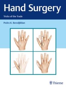 Hand Surgery : Tricks of the Trade