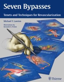 Seven Bypasses : Tenets and Techniques for Revascularization