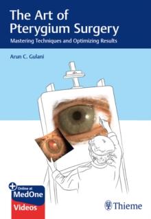 The Art of Pterygium Surgery : Mastering Techniques and Optimizing Results