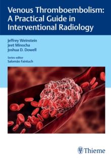 Venous Thromboembolism : A Practical Guide in Interventional Radiology