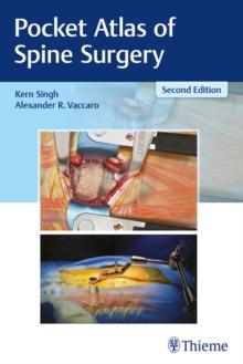 Pocket Atlas of Spine Surgery