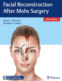 Facial Reconstruction After Mohs Surgery