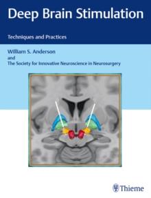 Deep Brain Stimulation : Techniques and Practices