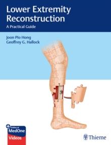 Lower Extremity Reconstruction : A Practical Guide