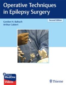 Operative Techniques in Epilepsy Surgery