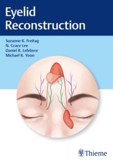 Eyelid Reconstruction