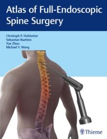 Atlas of Full-Endoscopic Spine Surgery