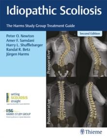 Idiopathic Scoliosis : The Harms Study Group Treatment Guide