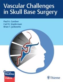 Vascular Challenges in Skull Base Surgery