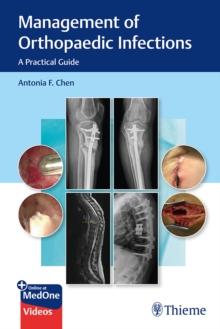 Management of Orthopaedic Infections : A Practical Guide