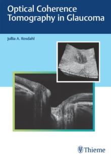 Optical Coherence Tomography in Glaucoma