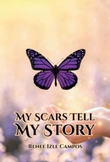 My Scars Tell My Story