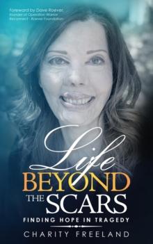 Life Beyond the Scars : Finding Hope in Tragedy