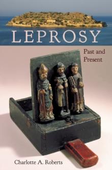 Leprosy : Past and Present