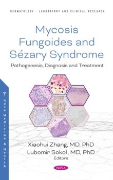 Mycosis Fungoides: Causes, Diagnosis and Treatment