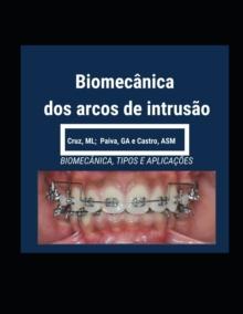 Biomecanica dos Arcos de Intrusao