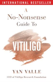 No-Nonsense Guide To Vitiligo. 2nd edition (2024)