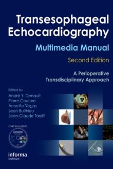 Transesophageal Echocardiography Multimedia Manual : A Perioperative Transdisciplinary Approach