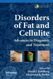 Disorders of Fat and Cellulite : Advances in Diagnosis and Treatment