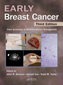 Early Breast Cancer : From Screening to Multidisciplinary Management, Third Edition