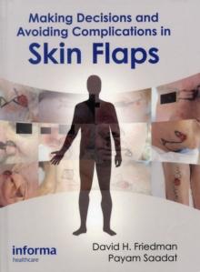 Making Decisions and Avoiding Complications in Skin Flaps