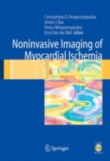 Noninvasive Imaging of Myocardial Ischemia