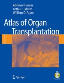 Atlas of Organ Transplantation