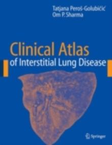 Clinical Atlas of Interstitial Lung Disease