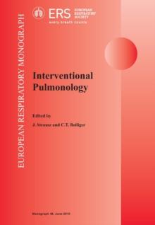 Interventional Pulmonology