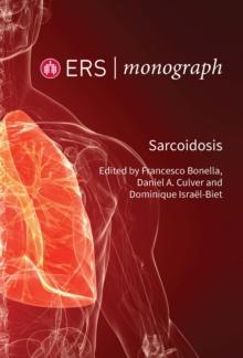 Sarcoidosis