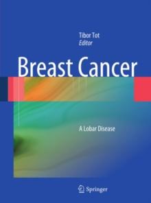 Breast Cancer : A Lobar Disease