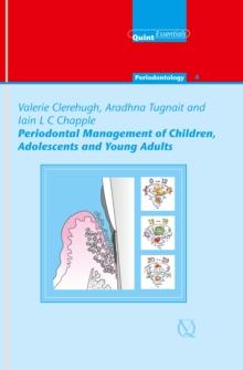 Periodontal Management of Children, Adolescents and Young Adults