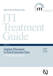 Implant Placement in Post-Extraction Sites : Treatment Options