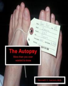 Autopsy: More than you ever wanted to know