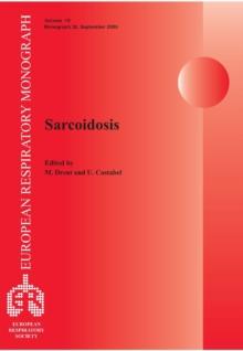 Sarcoidosis