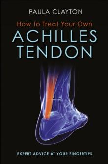 How to Treat Your Own Achilles Tendon