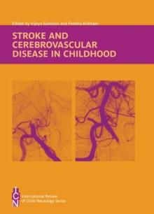 Stroke and Cerebrovascular Disease in Childhood