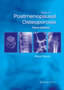 Atlas of Postmenopausal Osteoporosis : Third Edition