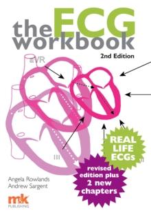 The ECG Workbook