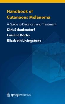 Handbook of Cutaneous Melanoma : A Guide to Diagnosis and Treatment