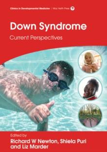 Down Syndrome : Current Perspectives