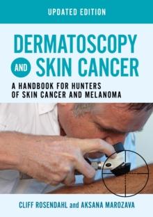 Dermatoscopy and Skin Cancer, updated edition : A handbook for hunters of skin cancer and melanoma