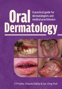 Oral Dermatology : A practical guide for dermatologists and medical practitioners