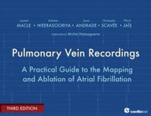 Pulmonary Vein Recordings : A Practical Guide to the Mapping and Ablation of Atrial Fibrillation